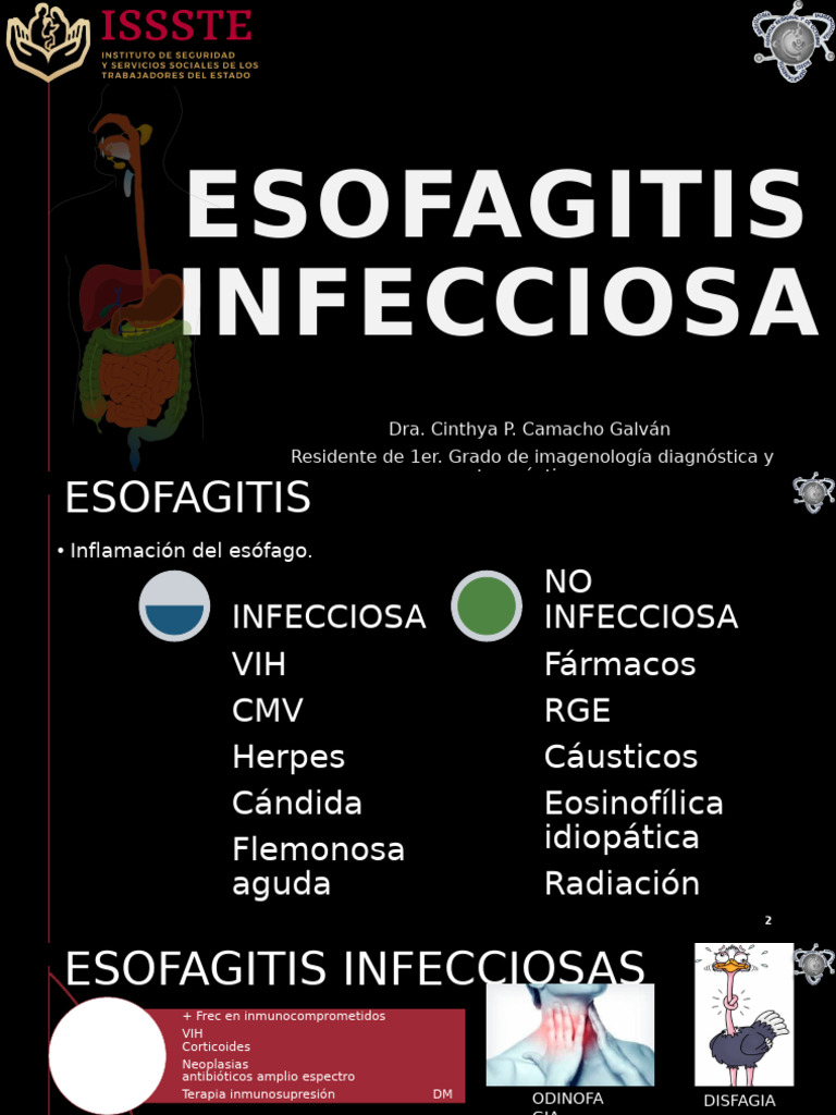 Esofagitis Infecciosa: Diagnóstico y Tratamiento | PDF | Especialidades ...