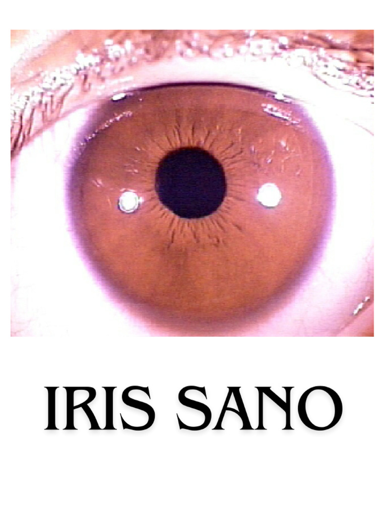Capleta: Salud a través del Iris | PDF