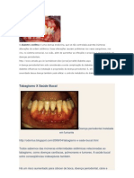 dença periodontal tb.