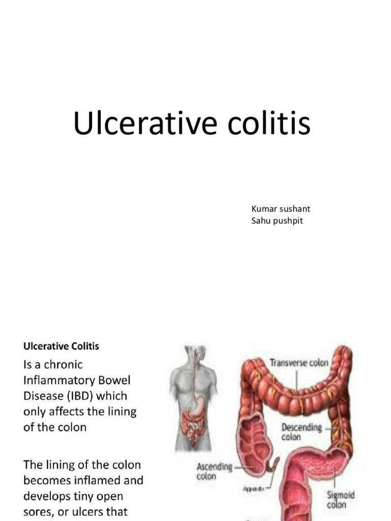 Extra-Abdominal Manifestations of Ulcerative Colitis | PDF