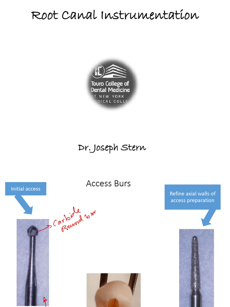 Root Canal Instrumentation Techniques | PDF | Dentistry Branches ...
