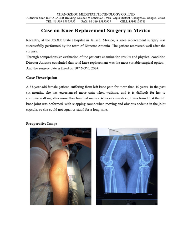 Knee Replacement Surgery Case Study | PDF | Knee | Surgery