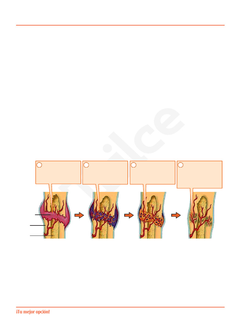 Remodelaci n Y Reparaci n sea Humana PDF Hueso Medicina