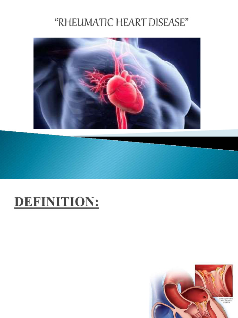 Rheumaticheartdisease 200130053230 | PDF | Immunology | Human Diseases ...