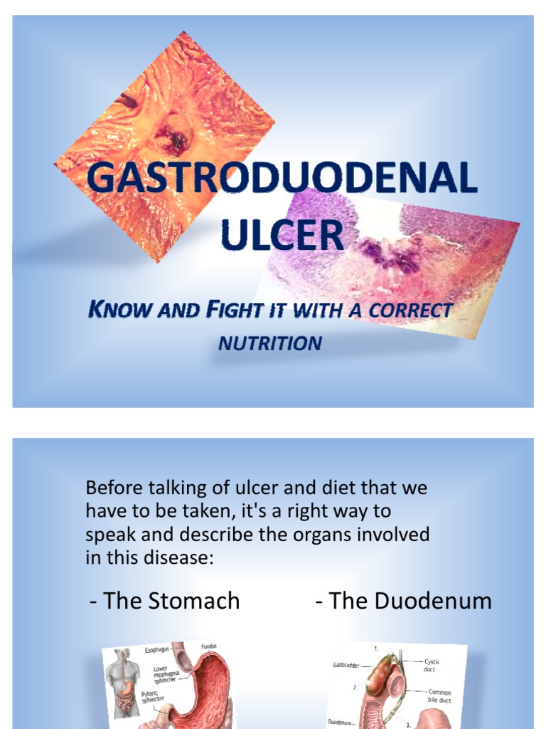 Gastroduodenal Peptic Ulcer | PDF | Stomach | Peptic Ulcer