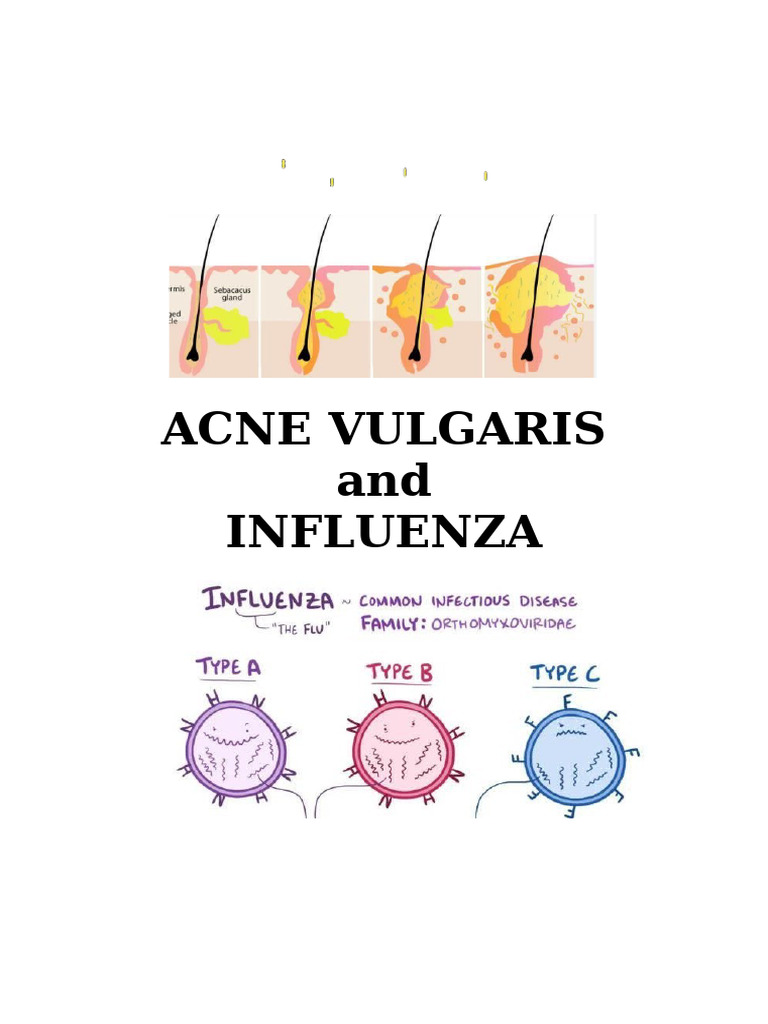 Acne Vulgaris and Influenza Overview | PDF | Influenza | Influenza A Virus