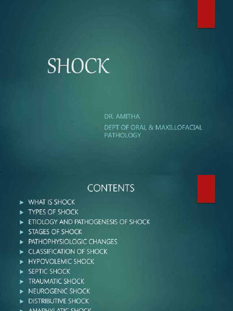 Shock | PDF
