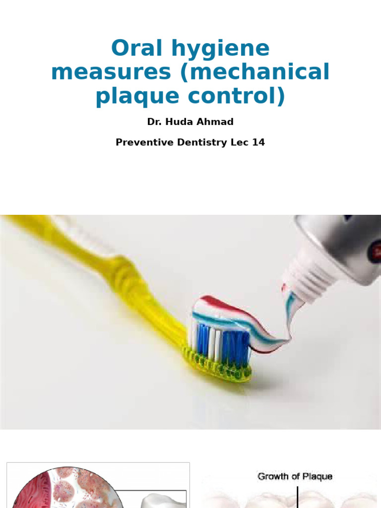 Preventive Dentistry Lec 14 | PDF | Toothbrush | Oral Hygiene