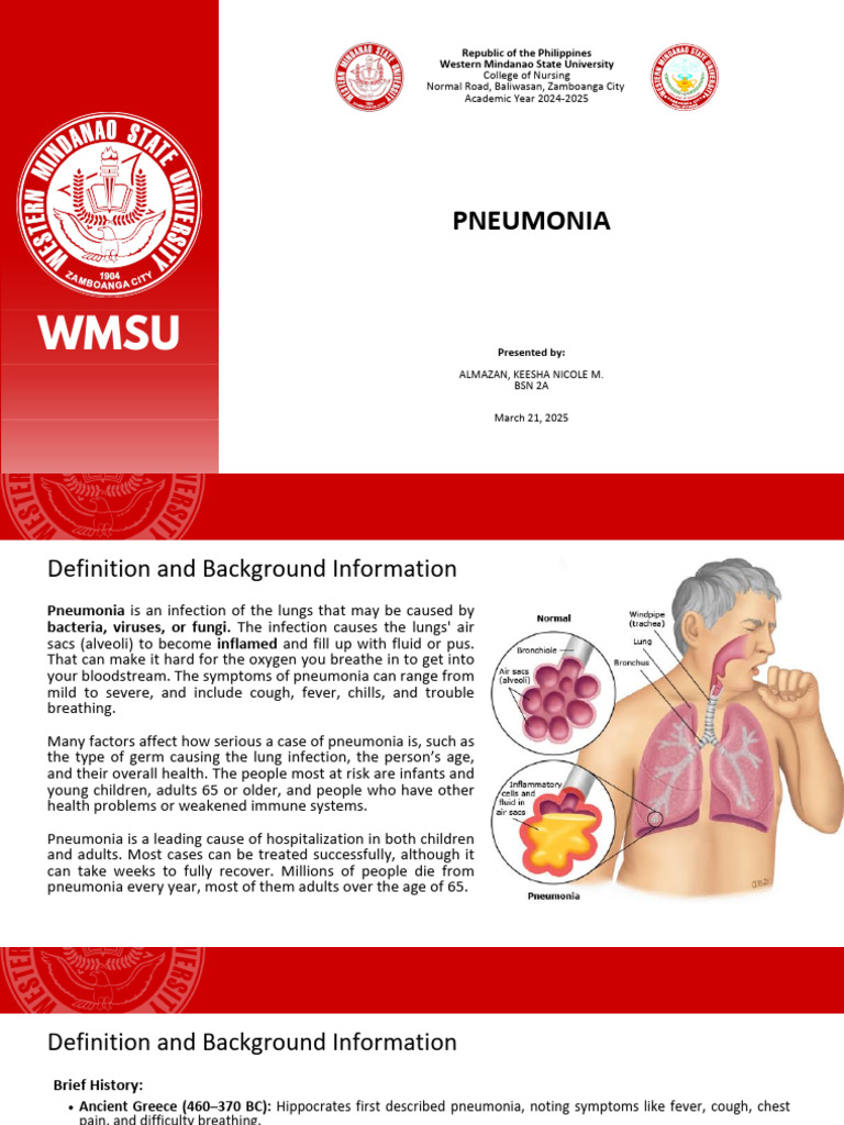 Understanding Pneumonia: Causes & Treatments | PDF | Pneumonia ...