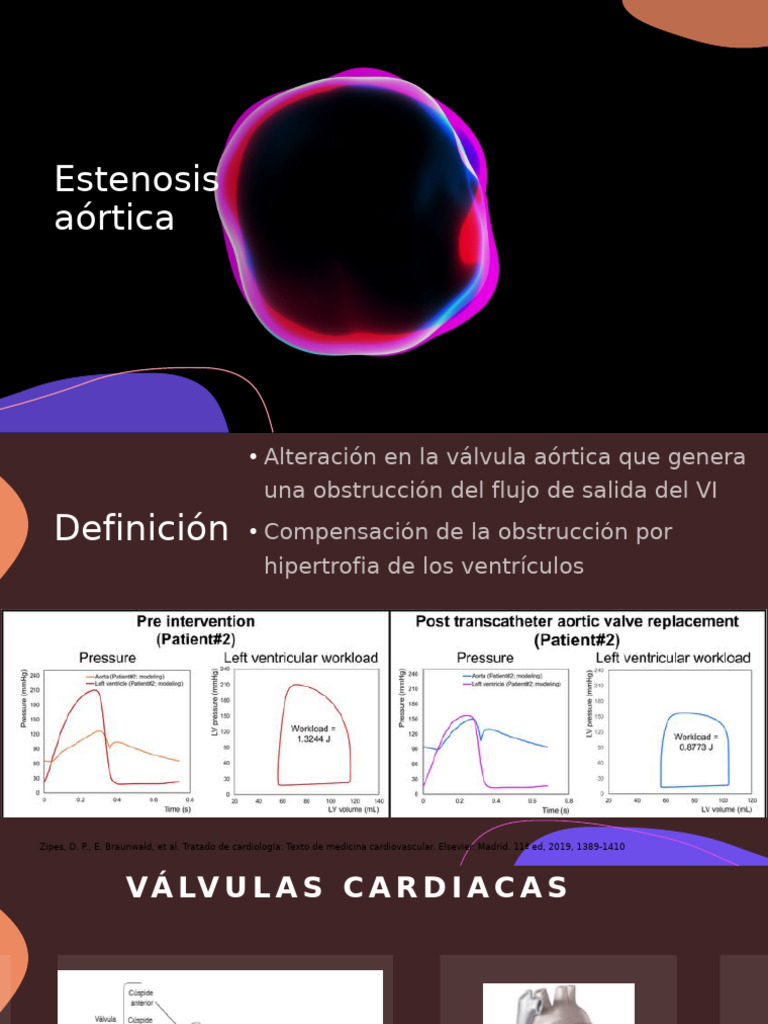 Estenosis Aórtica | PDF | Sistema cardiovascular | Corazón