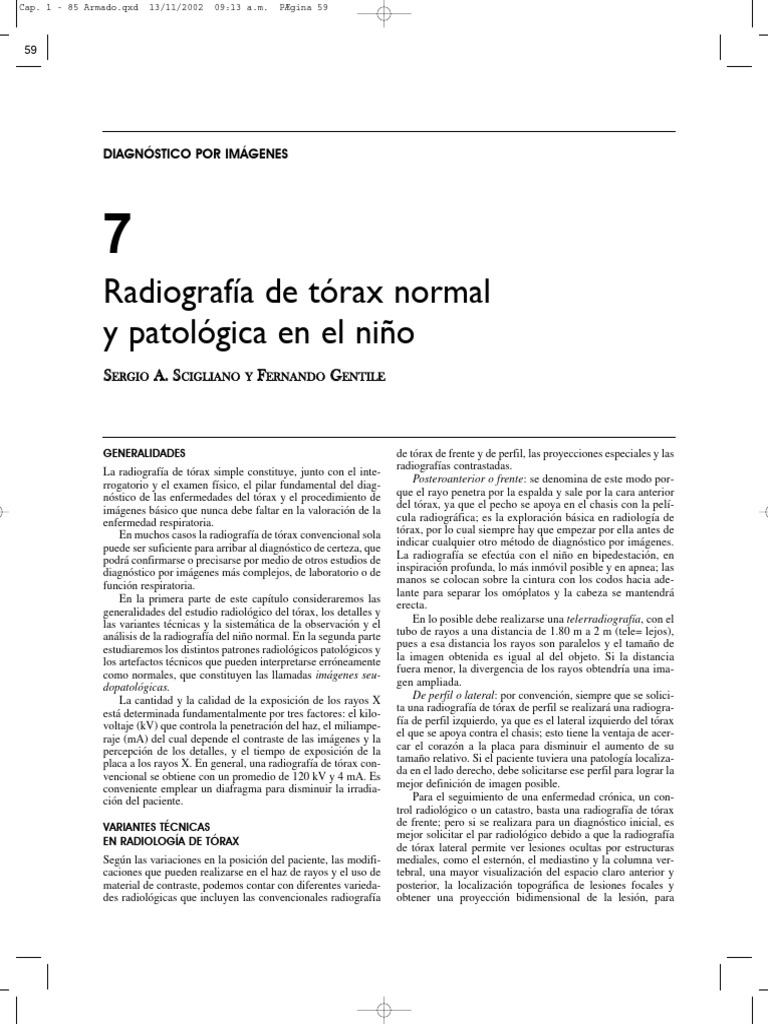 capituro-7-Rx-de-torax-normal---Macri-Teper- | PDF | Tórax | Pulmón