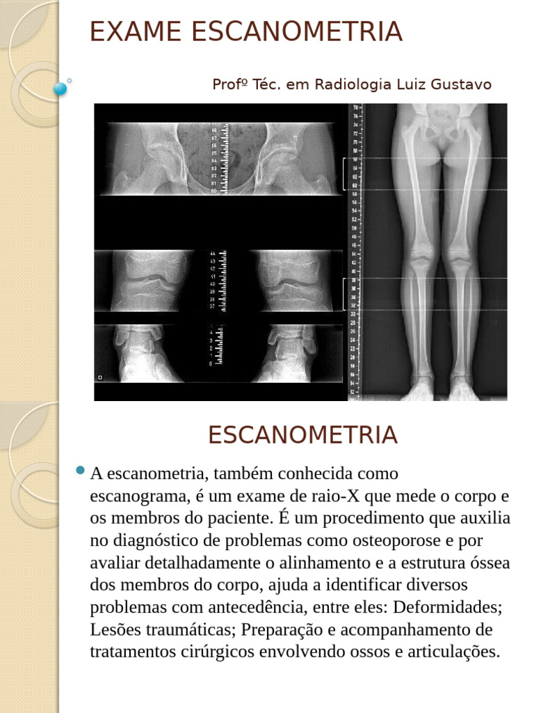 Escanometria | PDF