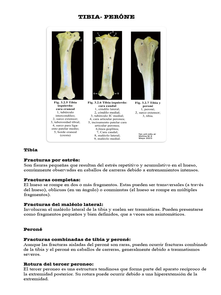 Fracturas de Tibia y Peroné en Caballos | PDF