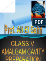 Class v Amalgam Cavity