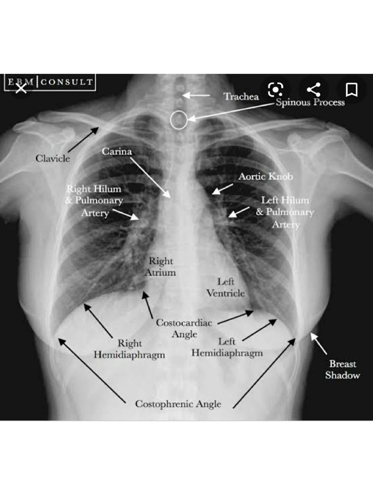 X Rays Radio | PDF