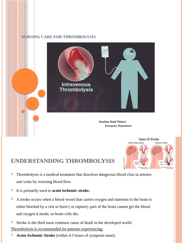 Thrombolysis Protocol for Stroke Care | PDF | Stroke | Intravenous Therapy