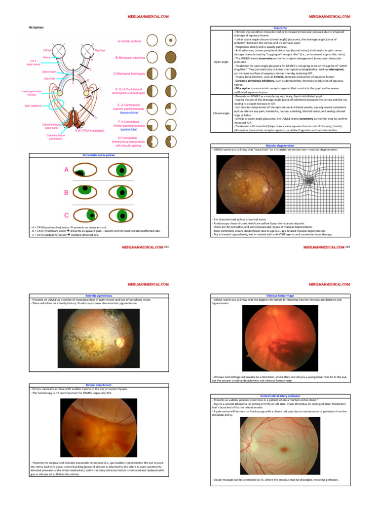 Glaucoma and Retinal Disorders Overview | PDF | Glaucoma | Medical ...