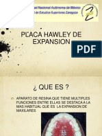 placa hawley