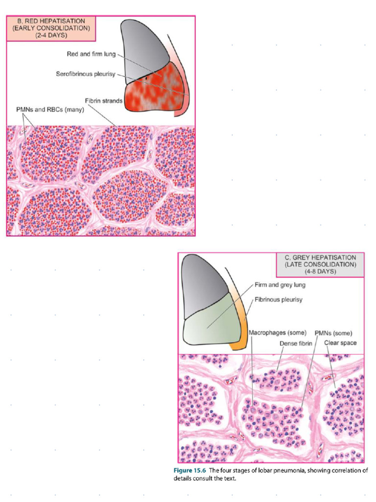 PS Histopath Diag | PDF