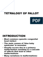 Tetralogy of Fallot Explained