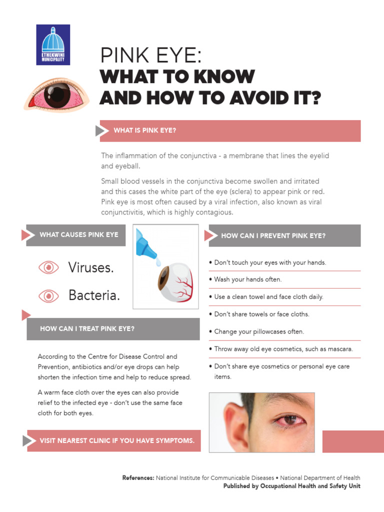 Preventing and Treating Pink Eye | PDF