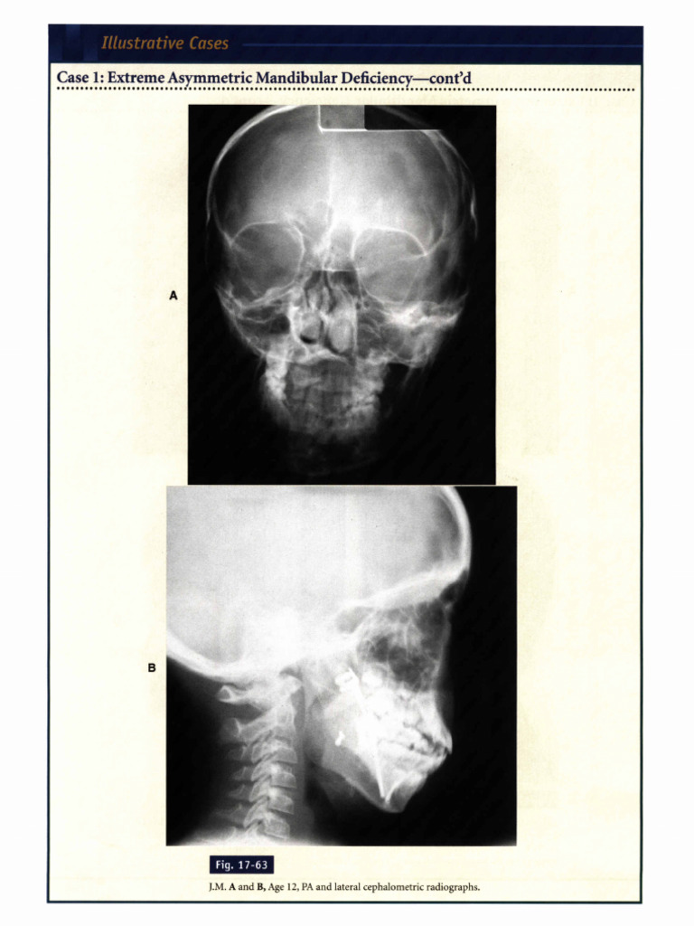 2003 Dentallib William R Proffit-580-650 (57-71) | PDF | Dentistry ...