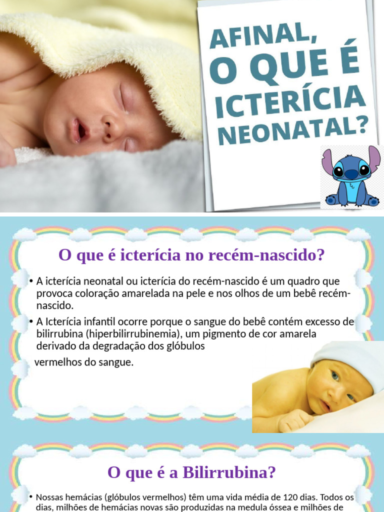 Icterícia Neonatal - Editado | PDF | Amamentação | Hemácia