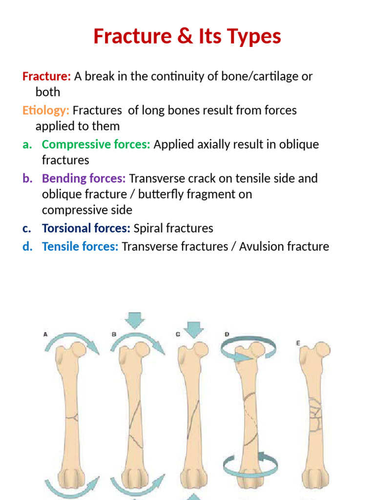 Fracture and Its Types | PDF | Musculoskeletal System | Injury