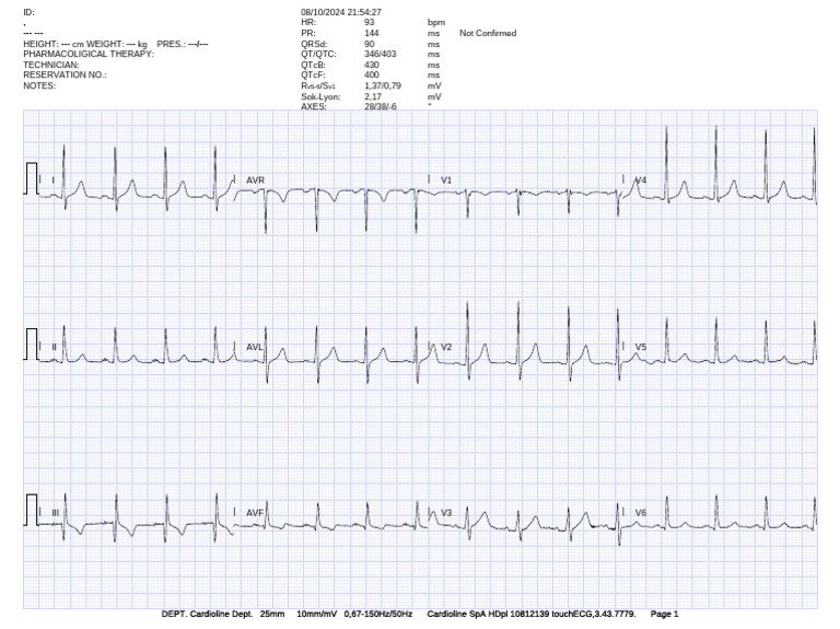 ECG Report Summary and Analysis | PDF