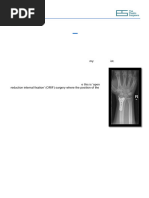 Splint Wear and Care Instructions | PDF