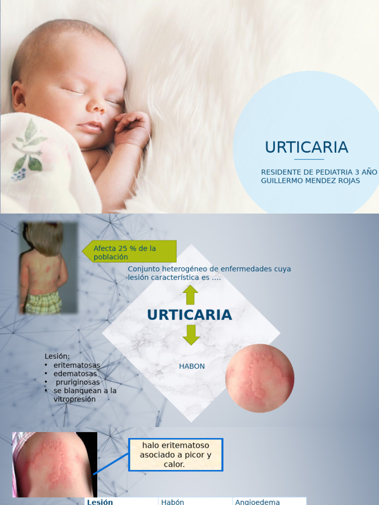 Urticaria en Pediatría: Clasificación y Tratamiento | PDF | Medicina ...