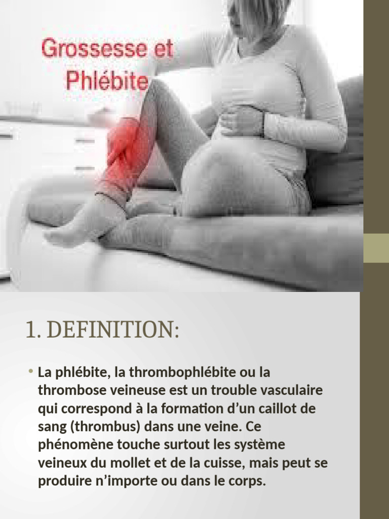 Phlébite : Signes et Gestion en Grossesse | PDF