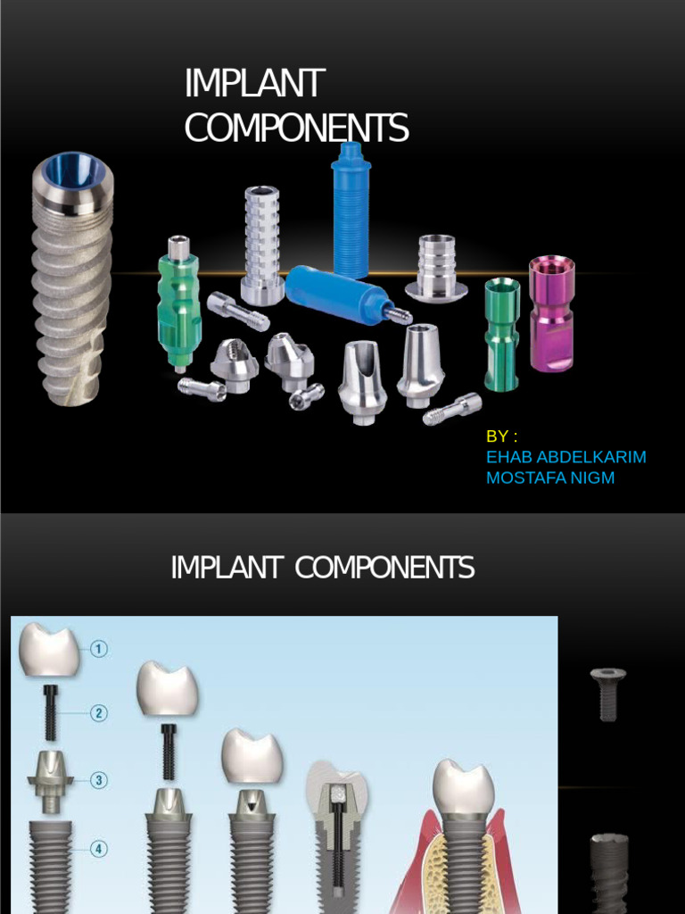 Implant Selection and Components Guide | PDF | Dental Implant | Stress ...