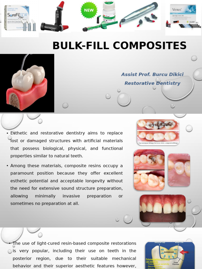 Overview of Bulk-Fill Composites | PDF | Dental Composite | Composite ...