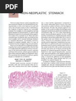 Corazza Villanacci Celiac Classification | PDF | Coeliac Disease ...