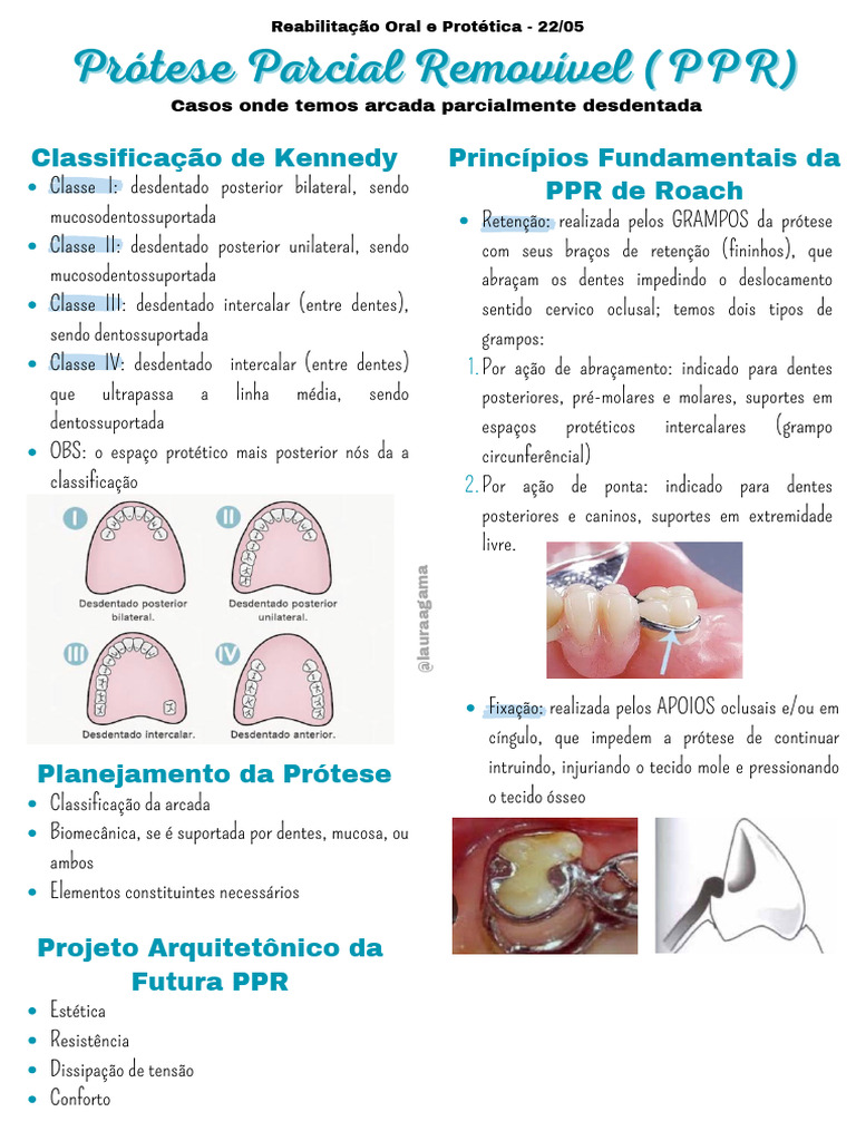 Guia Completo sobre Prótese Parcial Removível | PDF | Dente humano ...