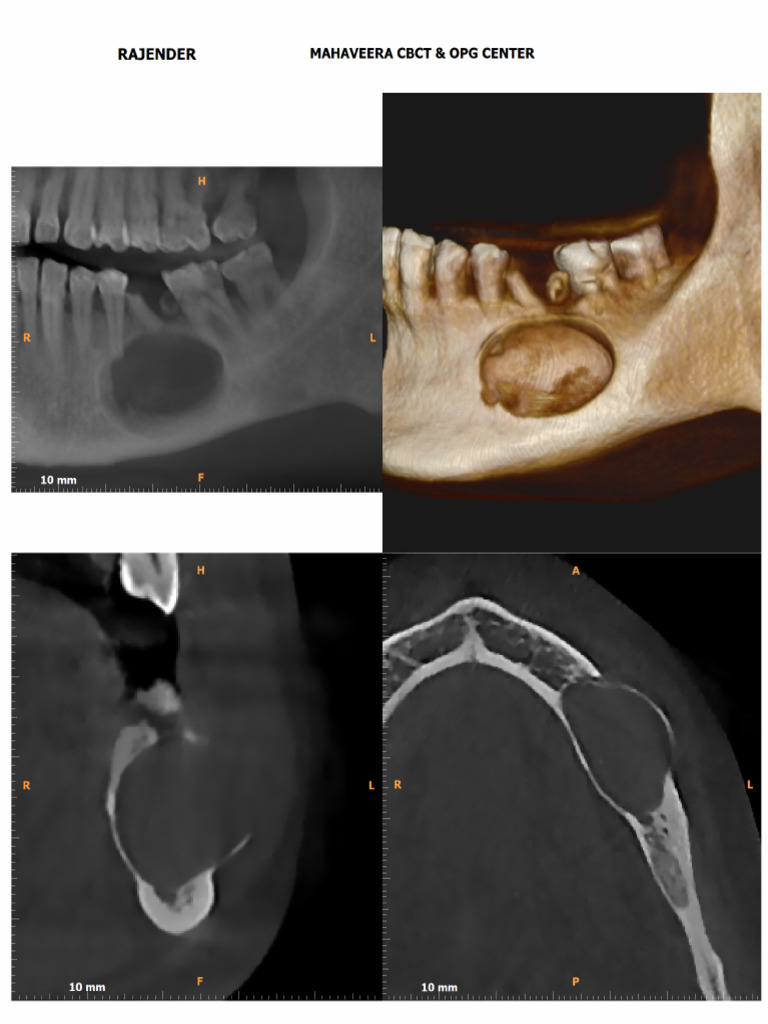 Rajender 3d | PDF
