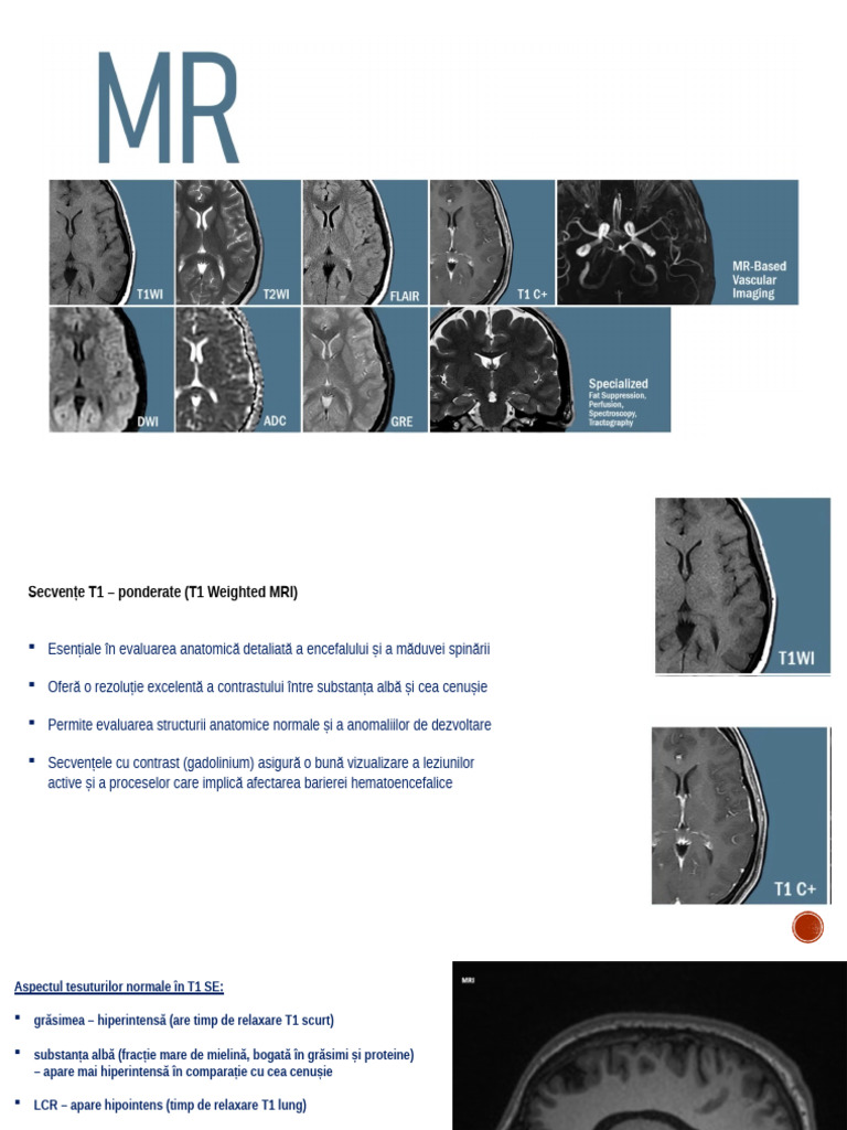 MRI | PDF