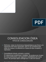 Consolidacion Osea