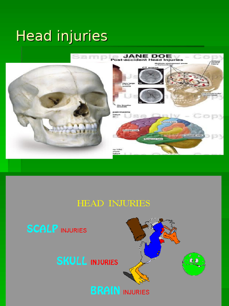 Understanding Head Injuries and Fractures | PDF | Diseases And ...