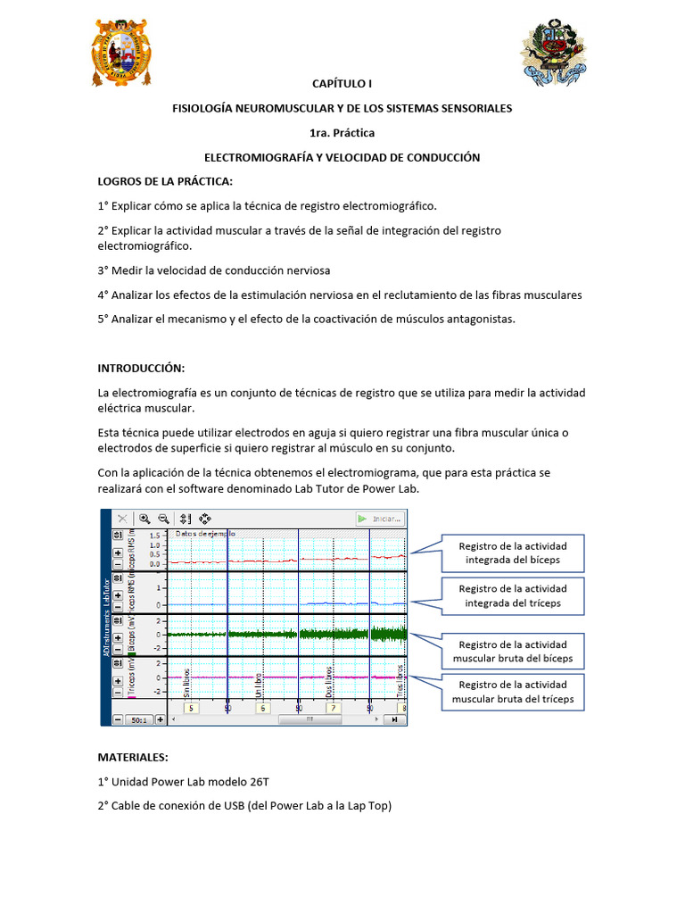 Electromiografía y Velocidad Nerviosa | PDF | Electromiografia | Fisiología