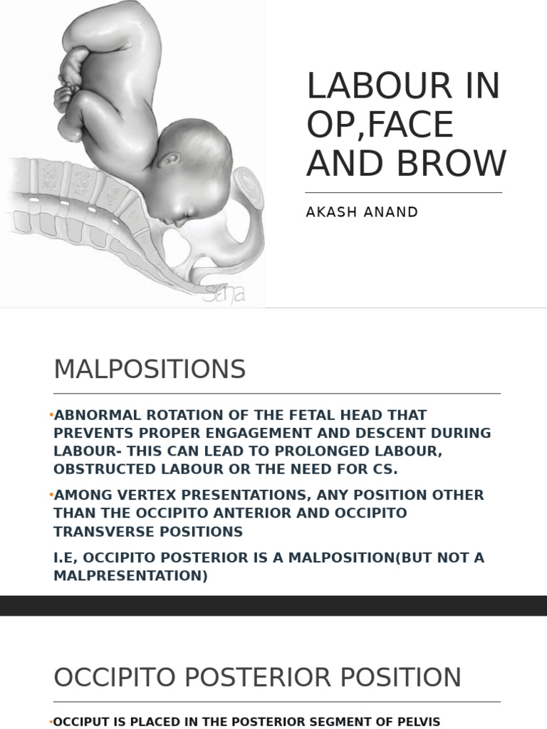Understanding Labour Malpositions: OP, Face, Brow | PDF | Pelvis ...