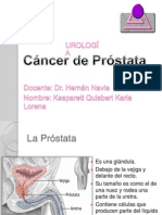 CÁNCER DE PRÓSTATA