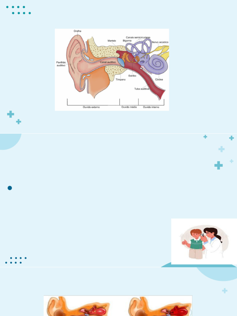 Classificação e Tratamento de Otites | PDF | Ciências da Saúde | Órgãos ...