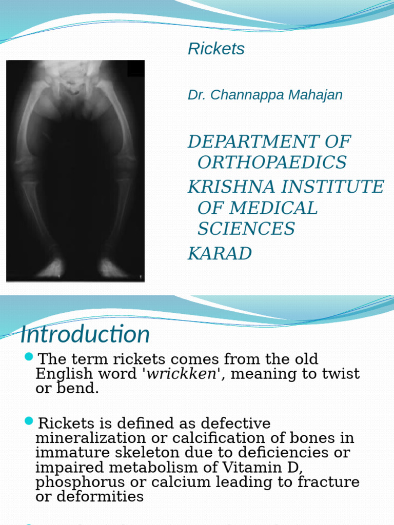 Understanding Rickets: Causes and Treatment | PDF | Vitamin D | Bone
