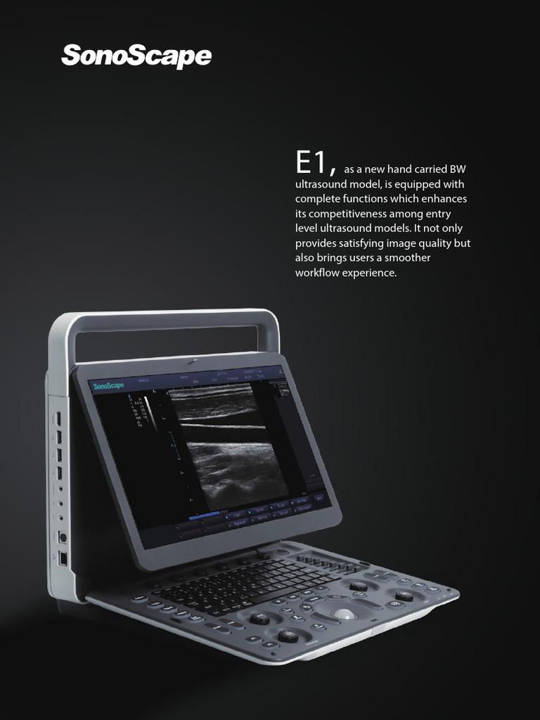 Sonoscape E1 Ultrasound Features | PDF