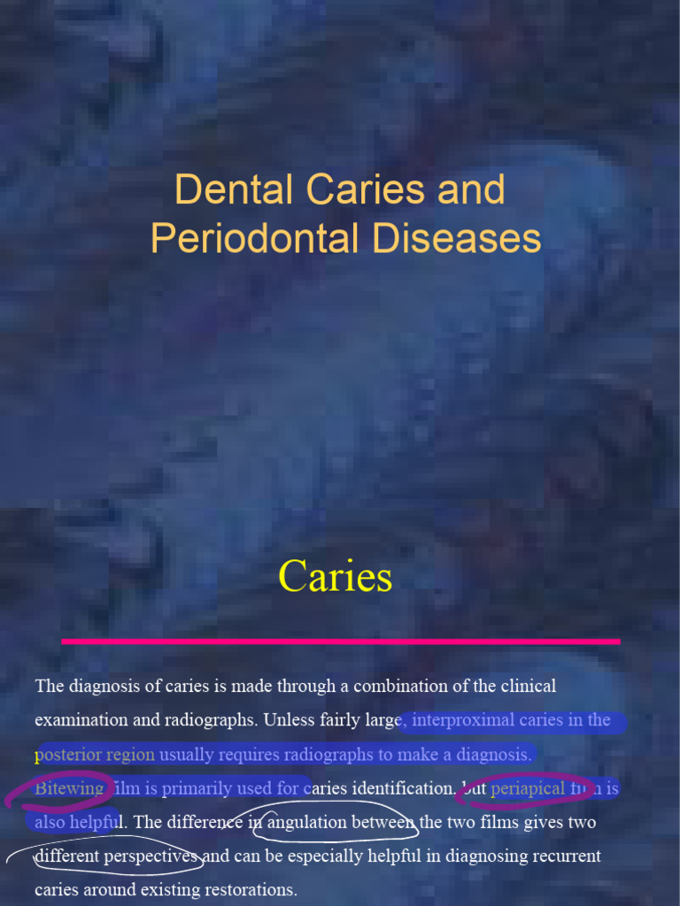 Diagnosing Dental Caries and Periodontal Disease | PDF | Tooth Enamel ...
