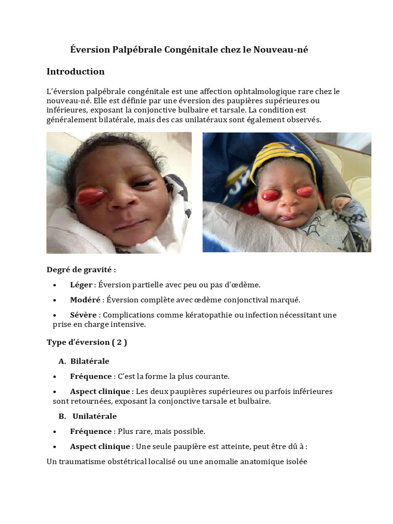 Éversion Palpébrale Congénitale chez le Nouveau-né | PDF | Trisomie 21 ...