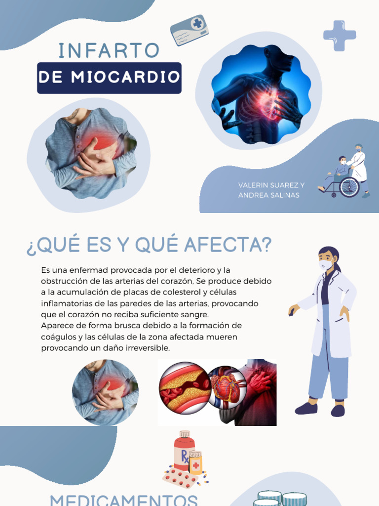 Infarto de Miocardio | PDF | Infarto de miocardio | Especialidades Medicas