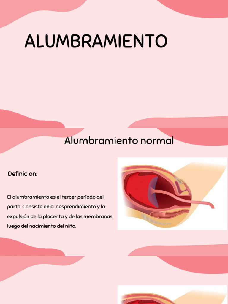Mecanismos de Alumbramiento: Baudelocque-Schultze | PDF | Parto | Placenta